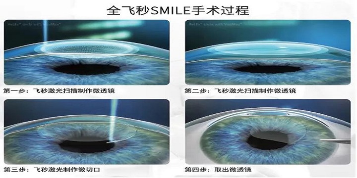 全飛秒,半飛秒 全飛秒,半飛秒