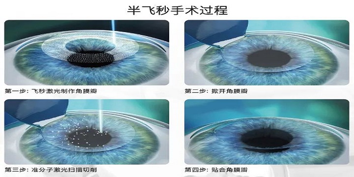 全飛秒,半飛秒 全飛秒,半飛秒