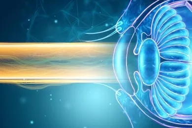 近視手術 近視手術