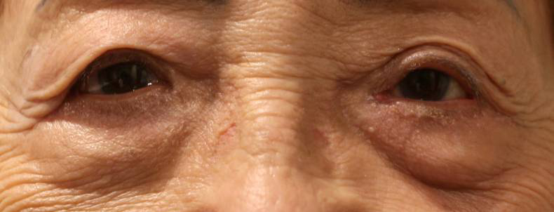 告別,臃腫,眼袋,有,這些,方法,又,是一,年春節(jié), 告別,臃腫,眼袋,有,這些,方法,又,是一,年春節(jié),