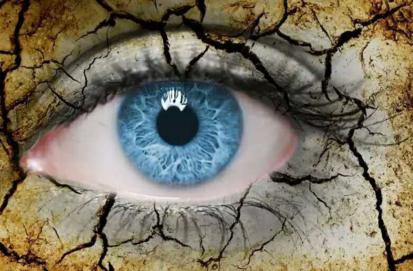 倒睫毛,結膜炎,眼結石,干眼癥,珠海希瑪眼科醫院 倒睫毛,結膜炎,眼結石,干眼癥,珠海希瑪眼科醫院