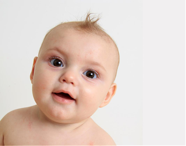 白內(nèi)障,白內(nèi)障手術(shù),兒童白內(nèi)障,天性白內(nèi)障,珠海 白內(nèi)障,白內(nèi)障手術(shù),兒童白內(nèi)障,天性白內(nèi)障,珠海