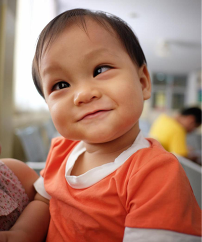 斜視,小兒斜視,治療斜視,珠海希瑪眼科醫院