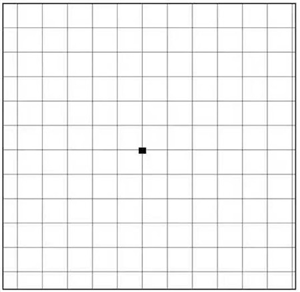 黃斑,視力下降,黃斑變性,老年黃斑,珠海希瑪眼科 黃斑,視力下降,黃斑變性,老年黃斑,珠海希瑪眼科