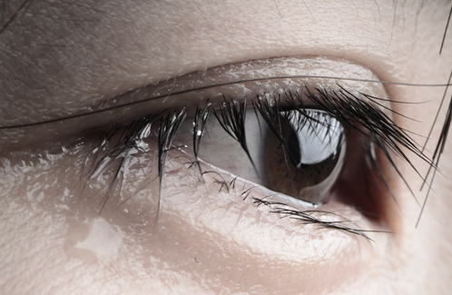 角膜炎,病毒性角膜炎,珠海希瑪眼科醫院