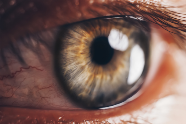 青光眼,近視手術,開角型青光眼,珠海希瑪眼科醫