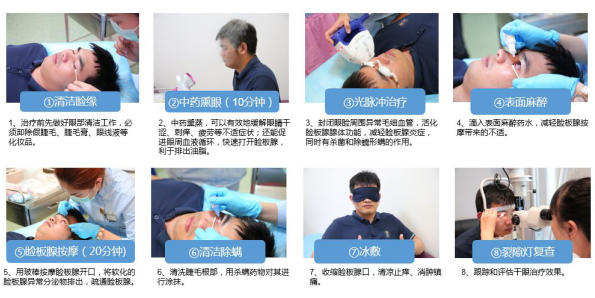 干眼癥的癥狀有哪些？