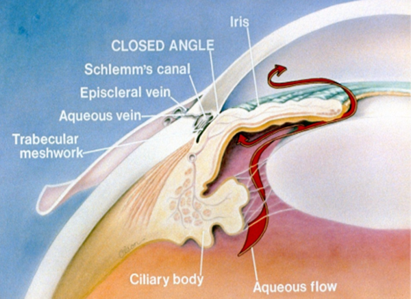 黃斑病變,珠海黃斑治療醫院,珠海希瑪林順潮眼科醫院 黃斑病變,珠海黃斑治療醫院,珠海希瑪林順潮眼科醫院