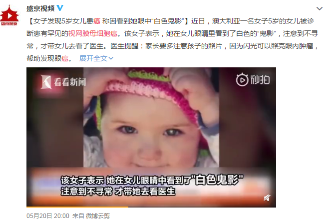 視網膜癌癥,視網膜母細胞瘤治療,珠海希瑪林順潮眼科醫院