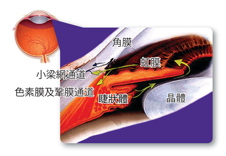 青光眼治療方法,珠海青光眼治療,珠海希瑪林順潮眼科醫院 青光眼治療方法,珠海青光眼治療,珠海希瑪林順潮眼科醫院