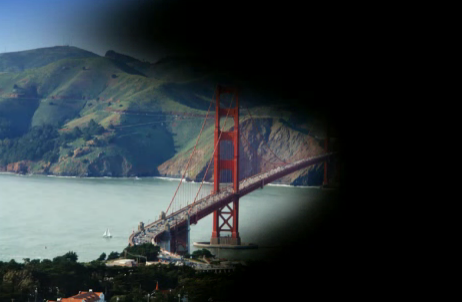 眼睛里面有黃斑怎么辦,黃斑變性怎治療,治療黃斑的醫院