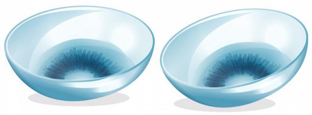 昆明OK鏡大概多少錢？