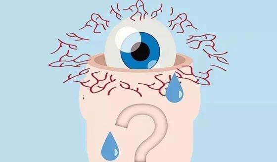 眼睛干澀如何解決,眼睛干得厲害怎么治療,眼睛干澀用什么藥 眼睛干澀如何解決,眼睛干得厲害怎么治療,眼睛干澀用什么藥
