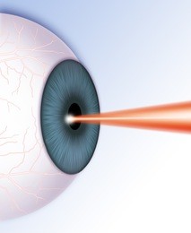 青光眼的預防方法,青光眼危害大嗎 青光眼的預防方法,青光眼危害大嗎